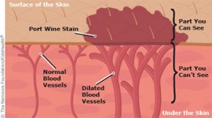 port-wine-diagram